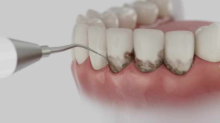 Reliable Dental contractor in West Salem, OH by Dentist Open Now